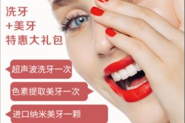 洗牙+美牙卡